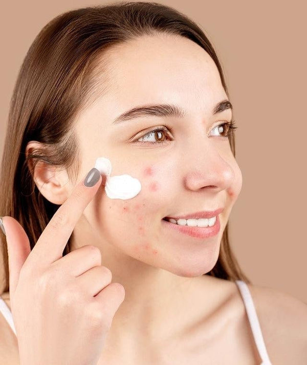 15 of the Best Japanese Skincare Products for Acne Prone Skin That You Can Buy Online-Japanese Taste